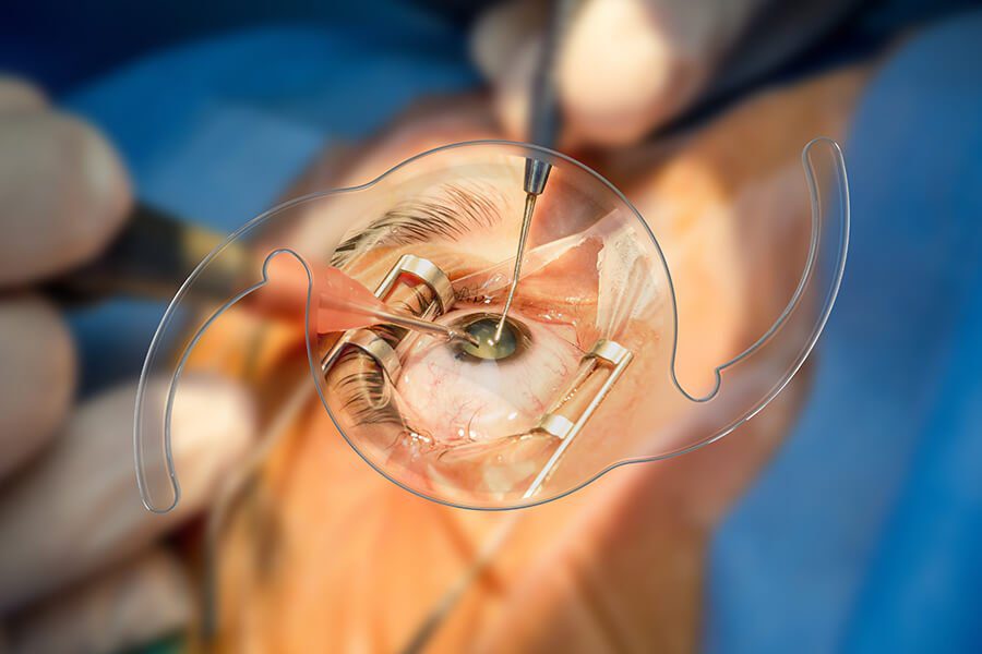 trifocal - dr. praveen saluja